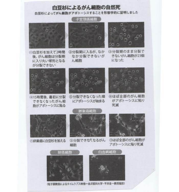 がん細胞がアポトーシス（自ら死ぬ）する様子の撮影に成功