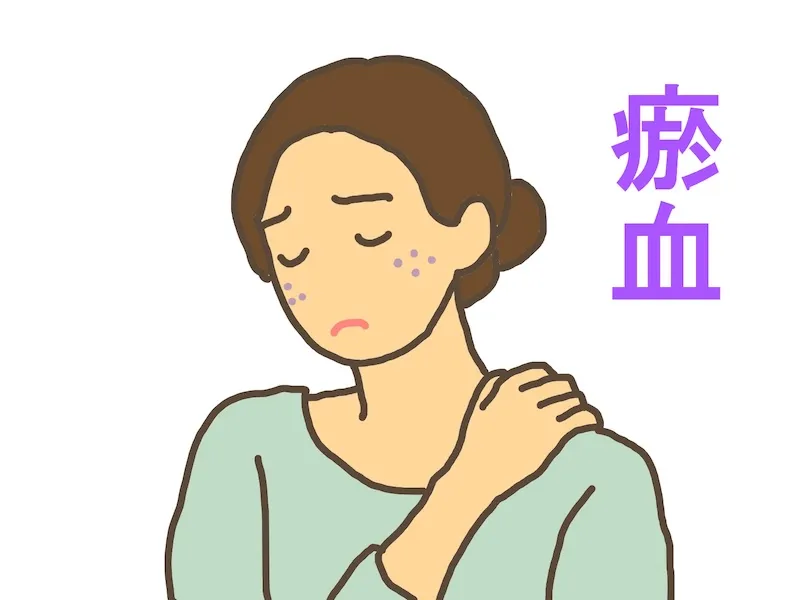 瘀血の女性